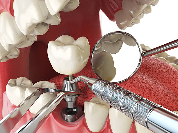 Best Weekend Emergency Dentist in Hannibal, MO